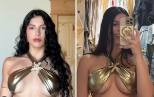 Rachel Arderi muestra el antes y después de su cirugía estética en Miami