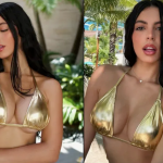 Rachel Arderi muestra el antes y después de su cirugía estética en Miami